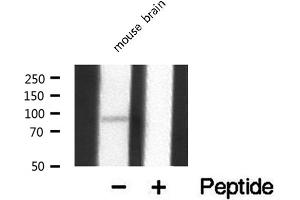 Western blot analysis of extracts from mouse Brian, using MEKKK 1 antibody. (MAP4K1 antibody  (Internal Region))