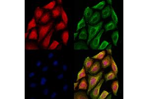 ABIN6264671 and ABIN6273069 staining Hela cells by IF/ICC.