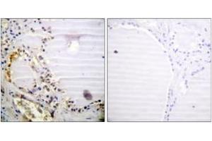 Immunohistochemistry analysis of paraffin-embedded human thyroid gland tissue, using RBBP8 (Ab-664) Antibody. (Retinoblastoma Binding Protein 8 antibody  (AA 630-679))