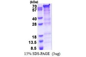 SDS-PAGE (SDS) image for Proline-Rich Transmembrane Protein 2 (PRRT2) (AA 1-268) protein (His tag) (ABIN5853508) (PRRT2 Protein (AA 1-268) (His tag))