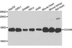 Western blot analysis of extract of various cells, using COX5B antibody. (COX5B antibody)