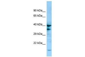 WB Suggested Anti-P2RY13 Antibody Titration: 1. (Purinergic Receptor P2Y, G-Protein Coupled, 13 (P2RY13) (C-Term) antibody)