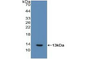 Western blot analysis of recombinant Human IL6R.