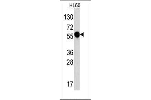 IL1RL2 antibody  (C-Term)
