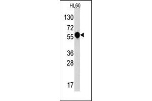 Western blot analysis of anti-IL1R in HL60 cell line lysates (35ug/lane). (IL1RL2 antibody  (C-Term))