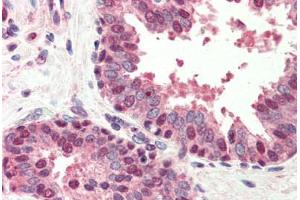 anti-BCL2-Interacting Killer (Apoptosis-Inducing) (BIK) (N-Term) antibody