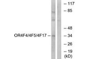 Western blot analysis of extracts from MCF-7 cells, using OR4F4/4F5/4F17 Antibody. (OR4F4/4F5/4F17 antibody  (AA 51-100))
