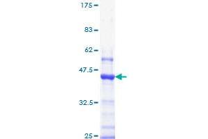Image no. 1 for Insulin-Like Growth Factor 1 Receptor (IGF1R) (AA 761-870) protein (GST tag) (ABIN1307545) (IGF1R Protein (AA 761-870) (GST tag))