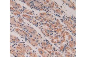 Used in DAB staining on fromalin fixed paraffin- embedded stomach tissue (CXCL5 antibody  (AA 41-114))
