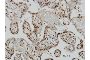Immunoperoxidase of monoclonal antibody to ZNF265 on formalin-fixed paraffin-embedded human placenta. (ZNF265 antibody  (AA 1-106))