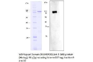 Western Blotting (WB) image for WD Repeat Domain 20 (WDR20) (AA 2-569) protein (His tag,GST tag) (ABIN3075585) (WDR20 Protein (AA 2-569) (His tag,GST tag))
