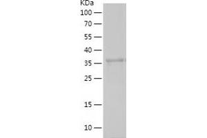 CNN2 Protein (AA 223-309) (His-IF2DI Tag)