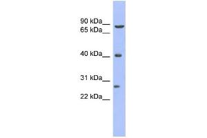 WB Suggested Anti-BRD3 Antibody Titration:  0. (BRD3 antibody  (Middle Region))