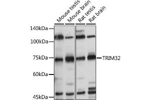Western blot analysis of extracts of various cell lines, using TRIM32 antibody (ABIN6132735, ABIN6149520, ABIN6149521 and ABIN6222878) at 1:500 dilution. (TRIM32 antibody  (AA 1-280))