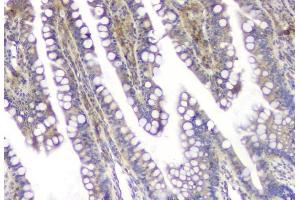 IHC analysis of SQSTM1 using anti-SQSTM1 antibody (ABIN3043937). (SQSTM1 antibody  (N-Term))
