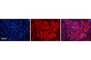 Rabbit Anti-NFATC1 Antibody    Formalin Fixed Paraffin Embedded Tissue: Human Adult heart  Observed Staining: Cytoplasmic Primary Antibody Concentration: 1:600 Secondary Antibody: Donkey anti-Rabbit-Cy2/3 Secondary Antibody Concentration: 1:200 Magnification: 20X Exposure Time: 0. (NFATC1 antibody  (Middle Region))
