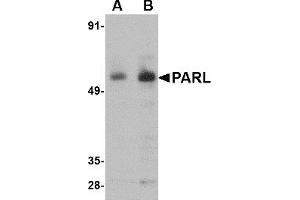 Western Blotting (WB) image for anti-Presenilin Associated, Rhomboid-Like (PARL) (N-Term) antibody (ABIN1031504) (PARL antibody  (N-Term))