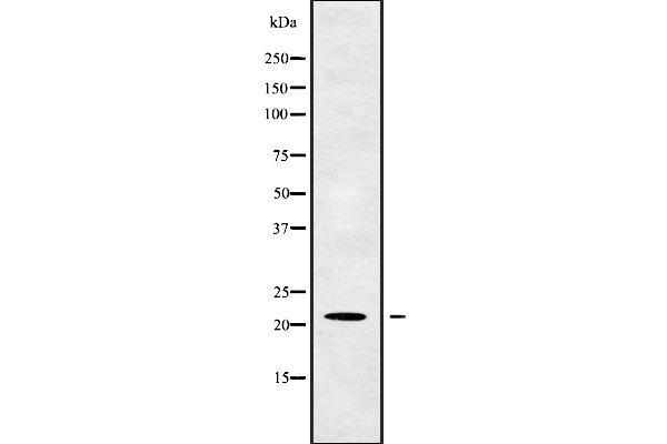 OAZ2 antibody  (Internal Region)