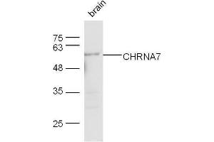 Mouse brain lysates probed with Rabbit Anti-CHRNA7 Polyclonal Antibody, Unconjugated  at 1:500 for 90 min at 37˚C. (CHRNA7 antibody  (AA 441-502))