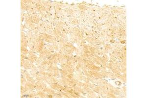 Immunohistochemistry of paraffin embedded rat heart using collagen alpha-1 (V) (ABIN7073547) at dilution of 1: 1800 (400x lens) (Collagen Type V antibody)