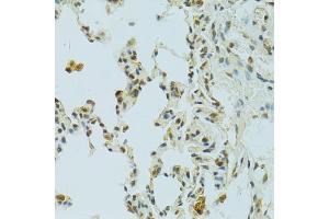 Immunohistochemistry of paraffin-embedded rat lung using RSRC1 antibody (ABIN5974341) at dilution of 1/100 (40x lens). (RSRC1 antibody)