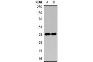 Western blot analysis of KIM1 expression in Hela (A), HEK293T (B) whole cell lysates. (HAVCR1 antibody  (N-Term))