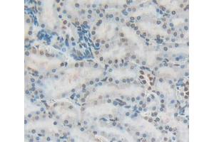 Used in DAB staining on fromalin fixed paraffin- embedded Kidney tissue (Fibrillarin antibody  (AA 85-274))