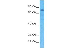 Host:  Rabbit  Target Name:  GPAT2  Sample Type:  Hela Whole Cell lysates  Antibody Dilution:  1. (GPAT2 antibody  (N-Term))