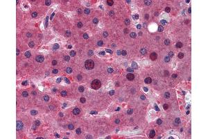 ZFAND6 antibody  (C-Term)