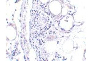 Immunohistochemistry of FABP7 in human breast tissue with FABP7 polyclonal antibody  at 5 ug/mL . (FABP7 antibody  (Internal Region))