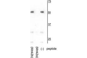 Western blot of HeLa lysate showing specific immunolabeling of the ~52 kDa Mnk2a isoform in the third lane (-). (MKNK2 antibody  (C-Term))