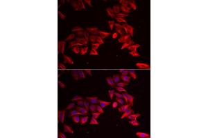 Immunofluorescence analysis of HeLa cells using SFRP4 antibody (ABIN6132004, ABIN6147678, ABIN6147679 and ABIN6222043).