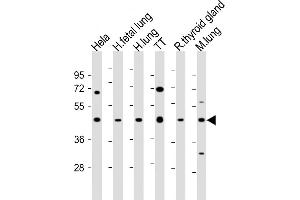 All lanes : Anti-NKX2-1 Antibody (N-term) at 1:2000 dilution Lane 1: Hela whole cell lysate Lane 2: human fetal lung lysate Lane 3: human lung lysate Lane 4: TT whole cell lysate Lane 5: rat thyroid gland lysate Lane 6: mouse lung lysate Lysates/proteins at 20 μg per lane. (NKX2-1 antibody  (N-Term))