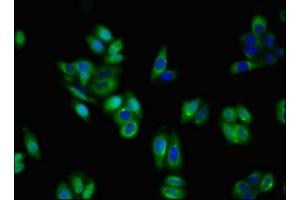 Immunofluorescent analysis of HepG2 cells using ABIN7155192 at dilution of 1:100 and Alexa Fluor 488-congugated AffiniPure Goat Anti-Rabbit IgG(H+L) (TRKA antibody  (AA 33-208))
