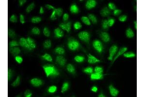 Immunofluorescence analysis of A549 cells using BIRC2 antibody (ABIN6292780). (BIRC2 antibody)