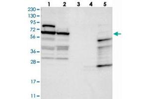 Western blot analysis of Lane 1: RT-4, Lane 2: U-251 MG, Lane 3: Human Plasma, Lane 4: Liver, Lane 5: Tonsil with NOP5/NOP58 polyclonal antibody  at 1:250-1:500 dilution. (NOP58 antibody)