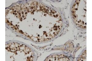 Immunoperoxidase of monoclonal antibody to CKAP2 on formalin-fixed paraffin-embedded human testis. (CKAP2 antibody  (AA 1-161))