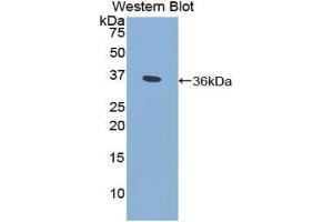 Detection of Recombinant CYP21A2, Human using Polyclonal Antibody to Cytochrome P450 Family 21 Subfamily A Member 2 (CYP21A2) (CYP21A2 antibody  (AA 106-389))