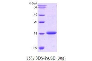 Figure annotation denotes ug of protein loaded and % gel used. (KIT Ligand (KITLG) (AA 26-189) Peptide)
