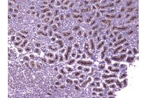 IHC analysis of CCL8 using anti-CCL8 antibody (ABIN6719605).
