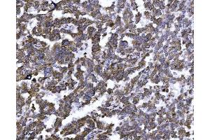 IHC analysis of ERLIN2 using anti-ERLIN2 antibody (ABIN7602582). (ERLIN2 antibody  (AA 87-339))