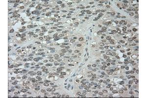 Image no. 5 for anti-Budding Uninhibited By Benzimidazoles 1 Homolog beta (Yeast) (BUB1B) antibody (ABIN1497000) (BUB1B antibody)