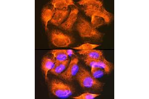 Immunofluorescence analysis of U-2 OS cells using PHKG2 Rabbit pAb  at dilution of 1:100 (40x lens). (PHKG2 antibody  (AA 237-406))