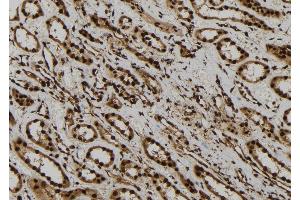 ABIN6277755 at 1/100 staining Human kidney tissue by IHC-P. (AGO1 antibody  (Internal Region))