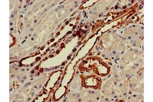 Immunohistochemistry of paraffin-embedded human kidney tissue using ABIN7155856 at dilution of 1:100 (TGIF2 antibody  (AA 82-222))