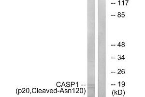 Western blot analysis of extracts from rat eye cells, using CASP1 (p20, Cleaved-Asn120) antibody. (Caspase 1 antibody  (Cleaved-Asn120, Internal Region))