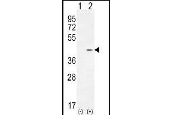 TWF2 anticorps  (N-Term)