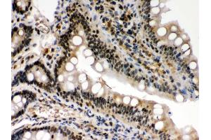 IHC(P): Rat Intestine Tissue (c-Rel antibody  (Middle Region))