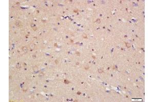 Formalin-fixed and paraffin embedded rat brain labeled with Rabbit Anti-JAMC Polyclonal Antibody, Unconjugated (ABIN1386406) at 1:200 followed by conjugation to the secondary antibody and DAB staining