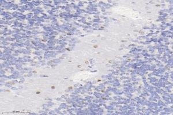 PLK5 antibody
